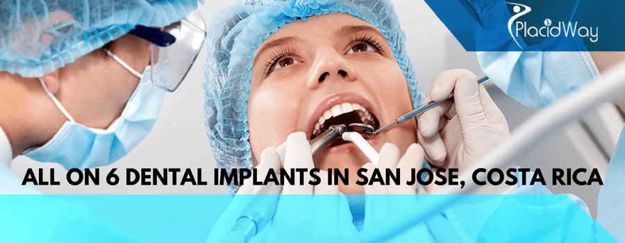 All on 6 Dental Implants in San Jose, Costa Rica